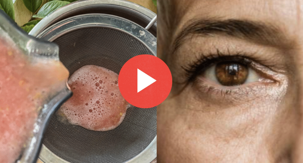 natural eye strain remedy